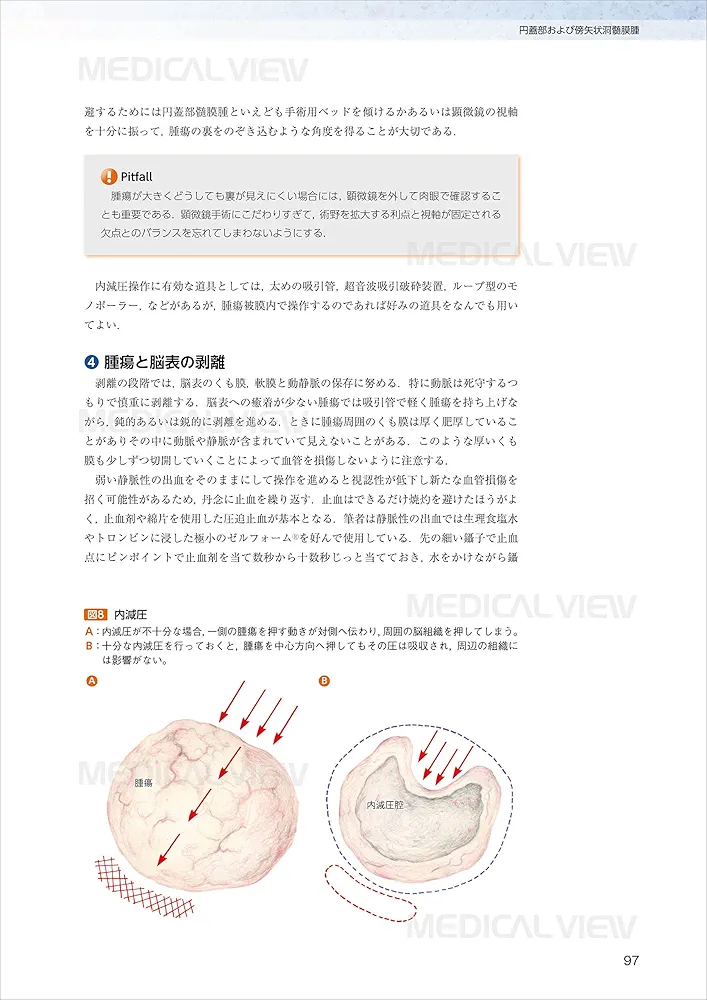 脳腫瘍外科経験したい手術16 スタンダードからアドバンス 脳腫瘍外科 経験したい手術16−スタンダードからアドバンス